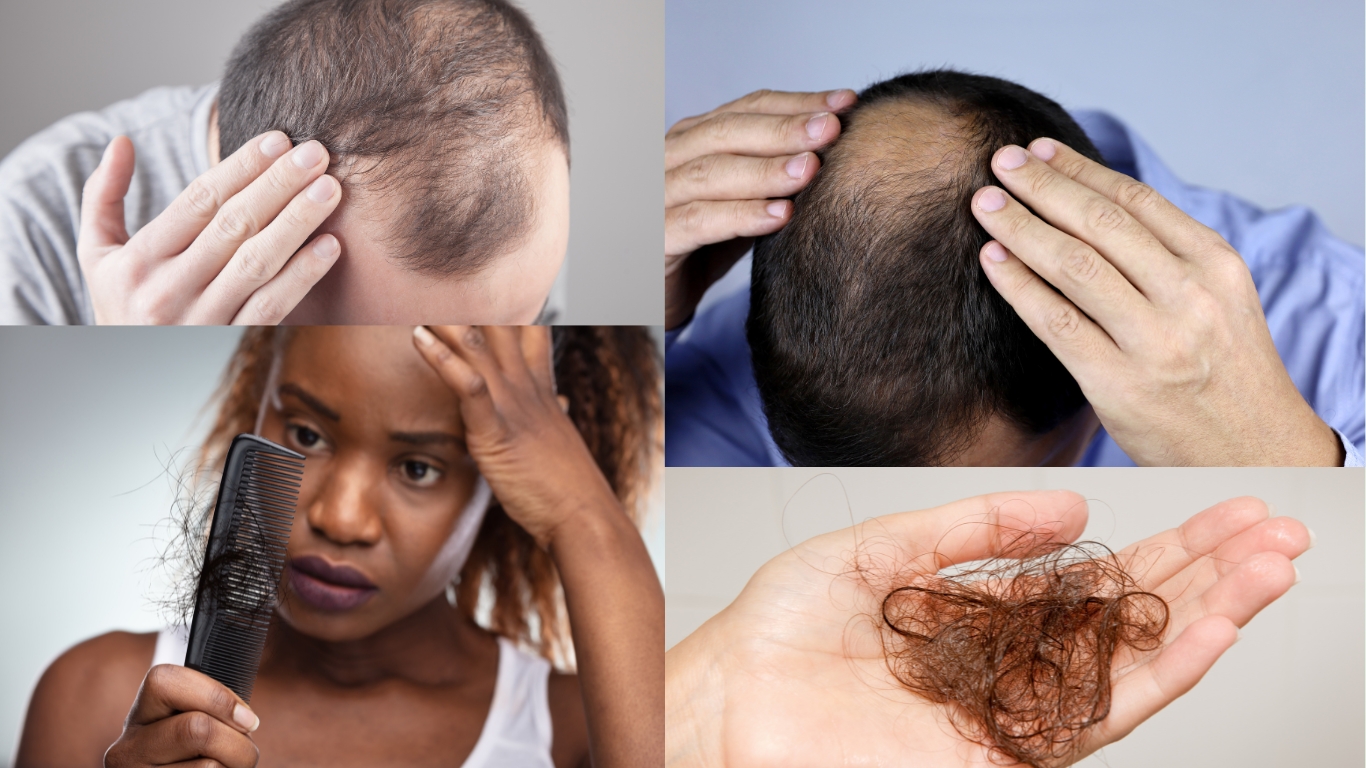 TrichoTest for Hair Loss